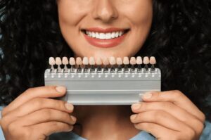 Read more about the article Dental Veneers Explained: Types, Benefits, and Treatment Process
